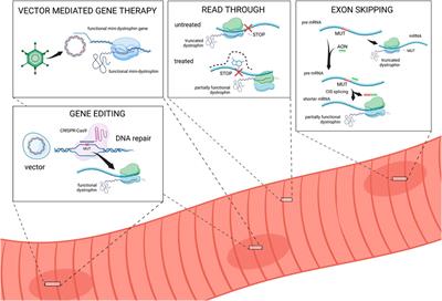 The complex landscape of DMD mutations: moving towards personalized medicine